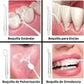 🦷 Irrigador Dental Pro Clean: Portátil, Recargable y Potente® ✨